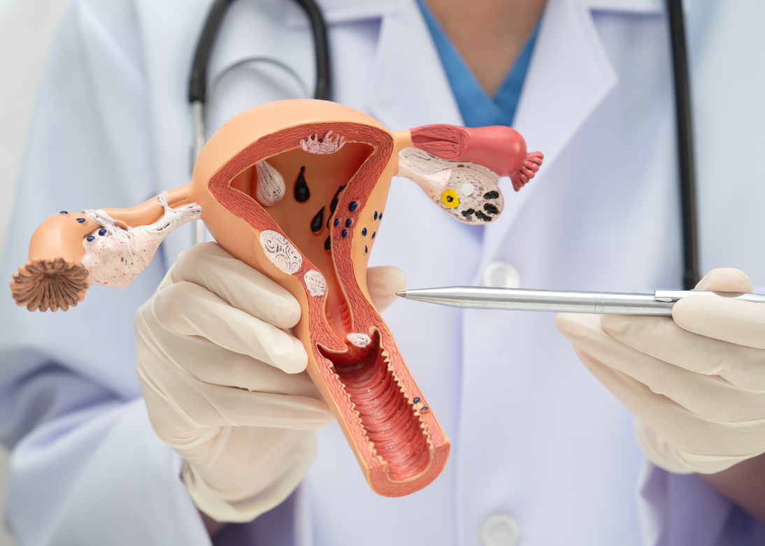 Gynecological Procedures